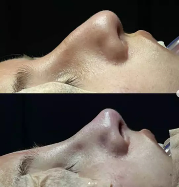 Slider image (4) Dr. Juan Sanabria Plastic Surgeon